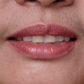 The Portrait Masters – The Retouching Series: Lip Hair Mustache